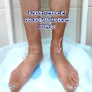 амлодипиновый отек