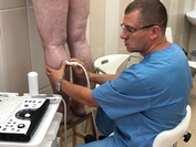 УЗИ делает флеболог