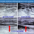 УЗИ сопровождение операции