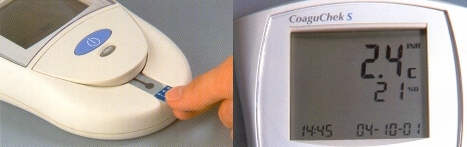 CoaguChek S
ЗАО Рош-Москва
ул. Смольная 24
тел. 258-2790