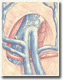 Рисунок 17. Удвоенная дуга тип
2. Два отдельных соустья.