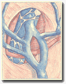 Рисунок 18. Удвоение дуги,
 тип 3. Замкнутое дублирование
