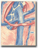 Рисунок 34: Добавочная
подкожная вена (ASV). Анастомоз с притоком дуги БПВ.