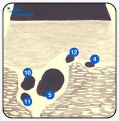 Паховый регион - Ультразвуковая картина
