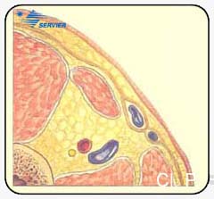 Перфорантные
вены приводящего канала (Перфоранты Додда). Анатомические варианты
и ультрасонографические корреляции