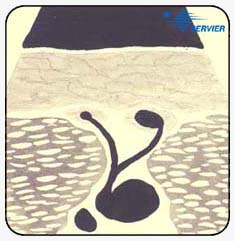 Перфорантные
вены приводящего канала (Перфоранты Додда). Анатомические варианты
и ультрасонографические корреляции.