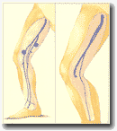 Рисунок 66. Большая и добавочная подкожные вены
