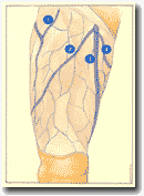 Рисунок 67. Проксимальные
притоки ствола большой подкожной вены.