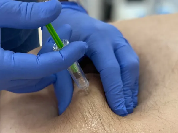 инъекция клексана