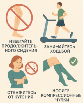Профилактика варикозной болезни