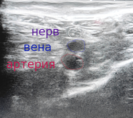 На мониторе в В режиме сканирования