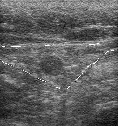 египетский глаз БПВ